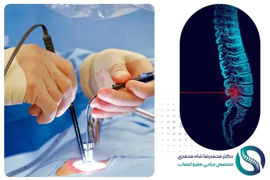 دکتر شاه محمدی متخصص جراحی دیسک کمر در تهران