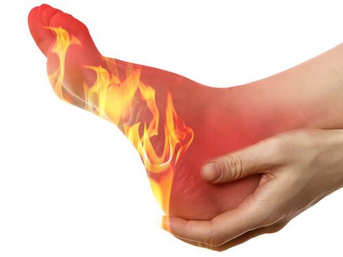 داغی و سوزش کف پا نشانه چیست؟