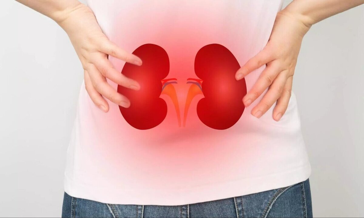 فعالیت در این ساعت ریسک سنگ کلیه را افزایش می‌دهد